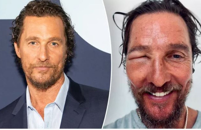 Matthew McConaughey