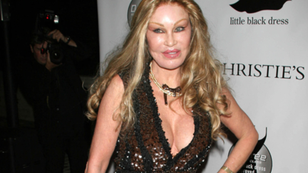 Η «Catwoman» Jocelyn Wildenstein πέθανε σε ηλικία 84 ετών