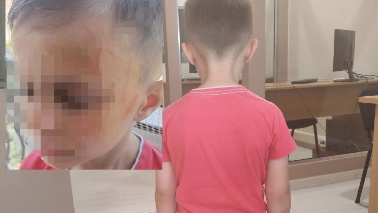 Εφιάλτης για 5χρονο στο Αγρίνιο: Τον έδειραν οι συμμαθητές του στο νηπιαγωγείο