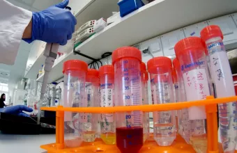 Ενδοθηλιοπάθεια σχετιζόμενη με διαταραχές της πηκτικότητας σε ασθενείς με COVID-19