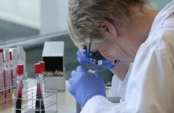 ΕΟΔΥ: Δεν υπάρχει κρούσμα ευλογιάς των πιθήκων στην Ελλάδα- Αυτά είναι τα συμπτώματα