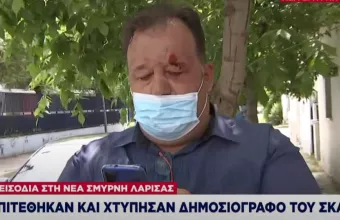 Γαρουφαλιάς για επίθεση Ρομά: «Με χτύπησαν την ώρα του ρεπορτάζ»