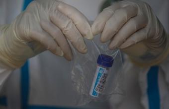 Ρωσία: Το εμβόλιο μας κατά του κορωνοϊού θα είναι καλύτερο από φυσική ανοσία