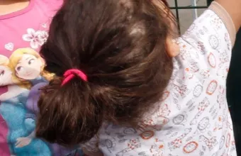 Σε ΜΕΘ νοσηλεύτηκαν  2 στα 10 παιδιά με το σύνδρομο MISC