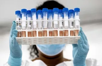 Από το mRNA στα νανοσωματίδια: Τα κυριότερα εμβόλια και θεραπείες για COVID - Oι ιδιότητές τους