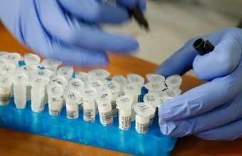 Αμερικανοί ερευνητές εργάζονται πάνω σε ένα ρινικό σπρέι κατά του κορωνοϊού