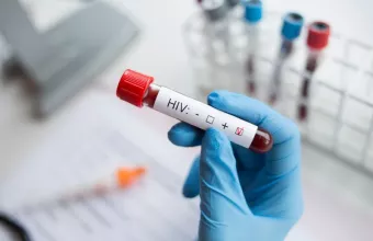 HIV: 500.000 νεκροί επιπλέον στη Νότια Αφρική σε 10 χρόνια
