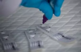 Στα 21.099 τα νέα κρούσματα, 51 νεκροί, 355 διασωληνωμένοι (πίνακες)
