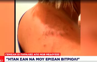 Μωβ Μέδουσα, Παραλίες, Χελώνα, 