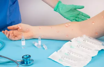 Ευλογιά των Πιθήκων