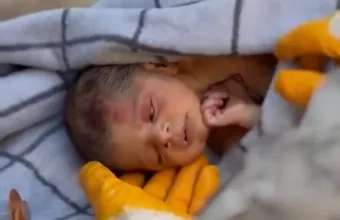 νεογεννητο-μαλλια