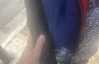 Επίθεση 