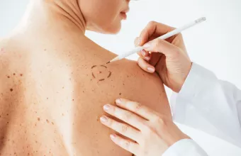 Ελένη Χατζηλάκου: Η Ελληνίδα ερευνήτρια που δίνει μάχη για την μη επεμβατική διάγνωση του μελανώματος 