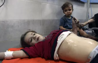  Η φρίκη των ακρωτηριασμένων παιδιών στην εμπόλεμη ζώνη