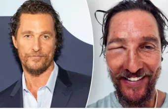 Matthew McConaughey