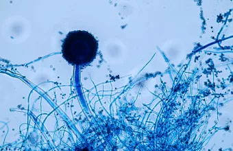 Aspergillus