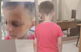 Ξυλοδαρός νηπιαγωγείο