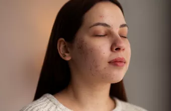 Ακμή και Φθινόπωρο