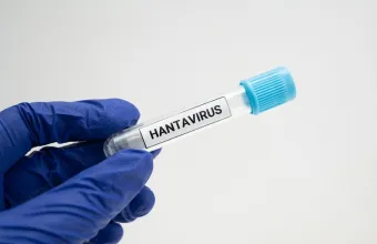 Δοκιμαστικός σωλήνας Hantavirus