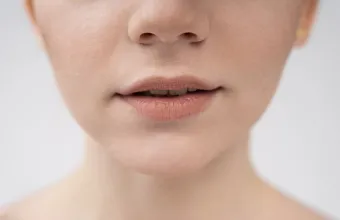 Lip basting: Το παράξενο beauty trick που μεταφέρει μια τεχνική του skincare στα σκασμένα χείλη