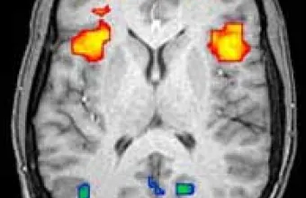 Brain Scan