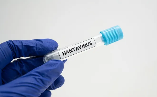 Δοκιμαστικός σωλήνας Hantavirus