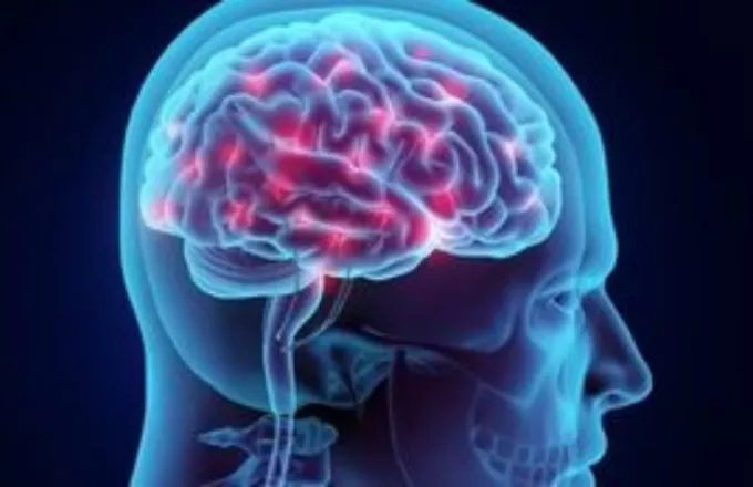 Συρρίκνωση και ατροφία του εγκεφάλου μπορεί να επιφέρει ακόμη και η ήπια Covid-19, σύμφωνα με μελέτη