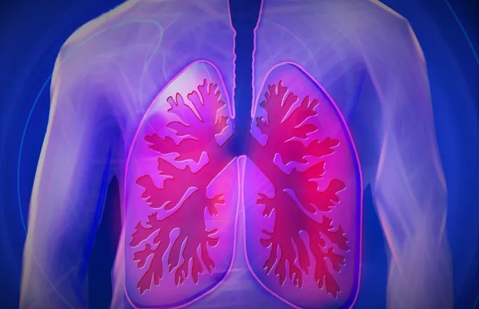 metropolitan lungs pnevmonia  px
