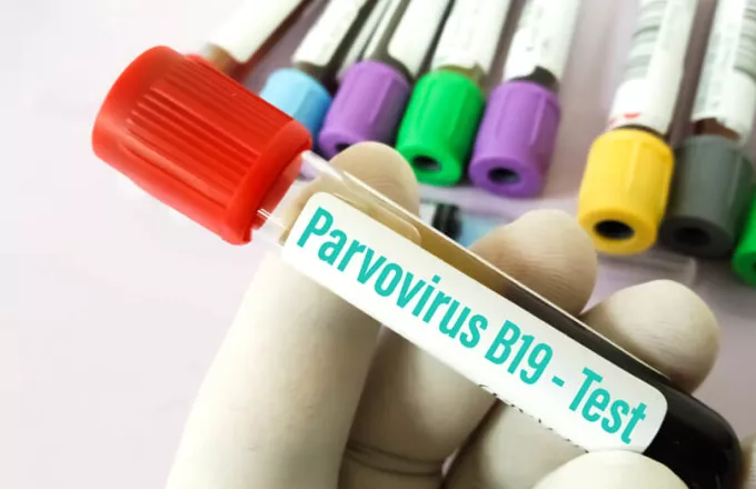 metropolitan parvovirus