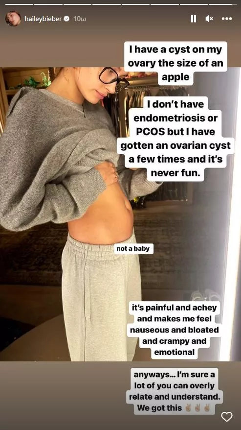 Η Hailey Bieber