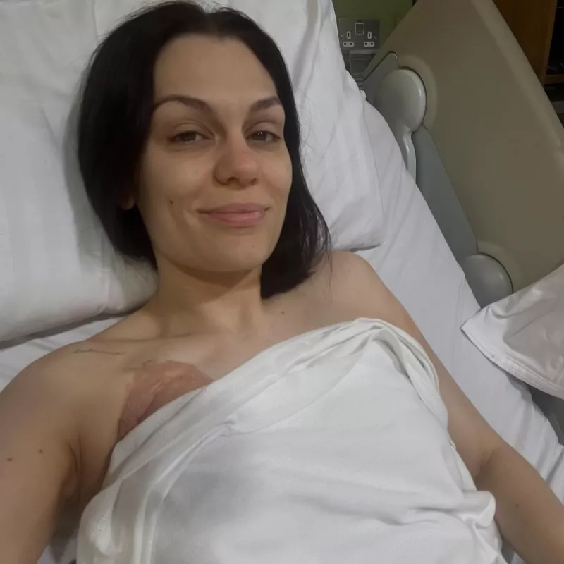 Jessie J