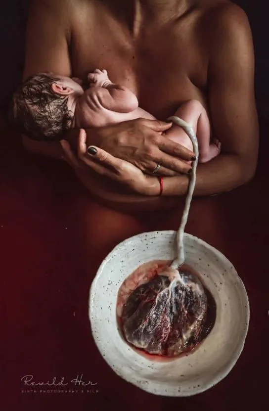 Ο διαγωνισμός «Birth Photography Image Competition»