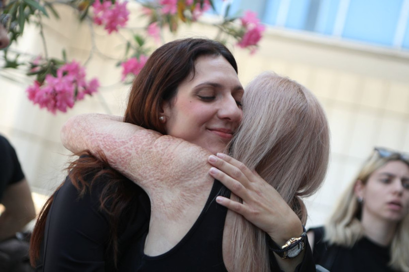 Μάτι φωτιά
