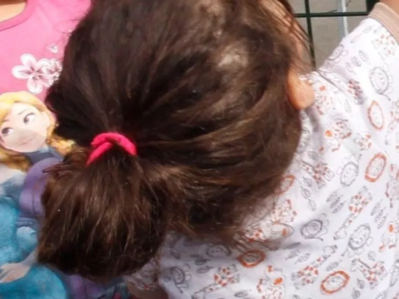 Σε ΜΕΘ νοσηλεύτηκαν  2 στα 10 παιδιά με το σύνδρομο MISC