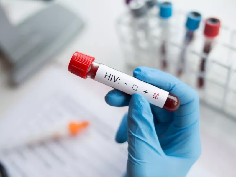 HIV: 500.000 νεκροί επιπλέον στη Νότια Αφρική σε 10 χρόνια