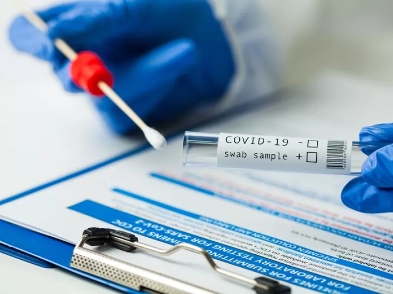 Eισήγηση επιτροπής ειδικών: Μόνο με PCR τεστ το πιστοποιητικό νόσησης για τους ανεμβολίαστους