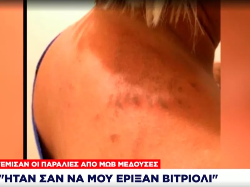 Μωβ Μέδουσα, Παραλίες, Χελώνα, 