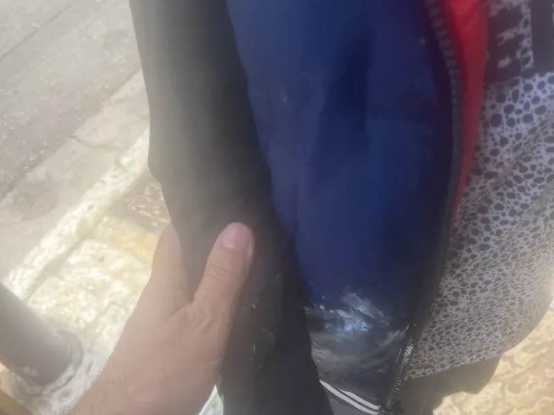 Επίθεση 