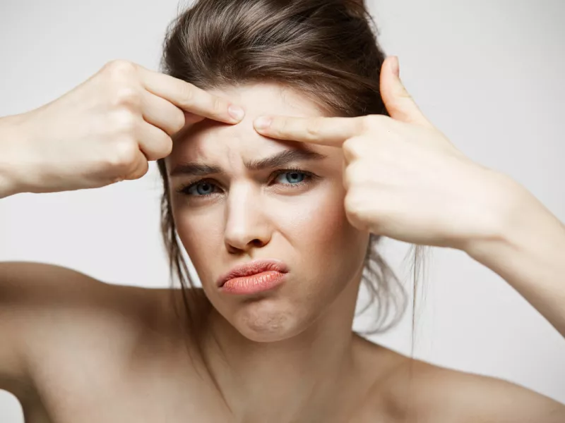 Acne skin: Ο φυσικός τρόπος για να διώξετε τα ενοχλητικά σπυράκια απο το πρόσωπο