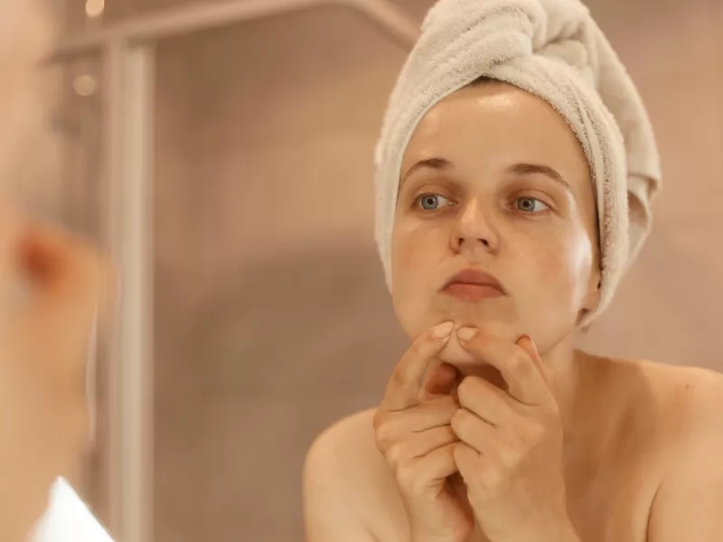 Acne skin: Τα συστατικά που δεν πρέπει να βάζεις στο πρόσωπό σου αν έχεις ακμή