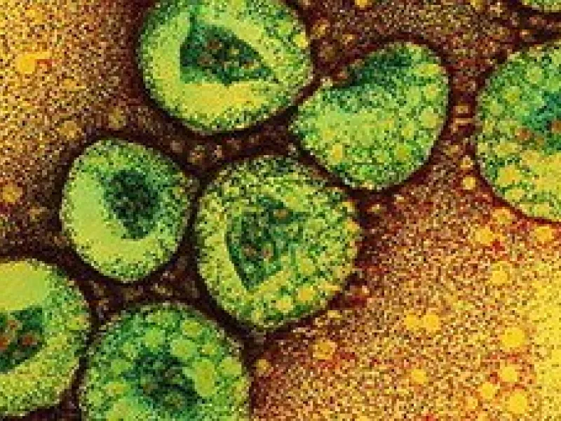 Μπέρδεμα με το όνομα του κορωνοϊού: SARS-CoV-2 ο ιός, Covid-19 η νόσος